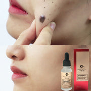 Organic Skin Tag Removal Serum